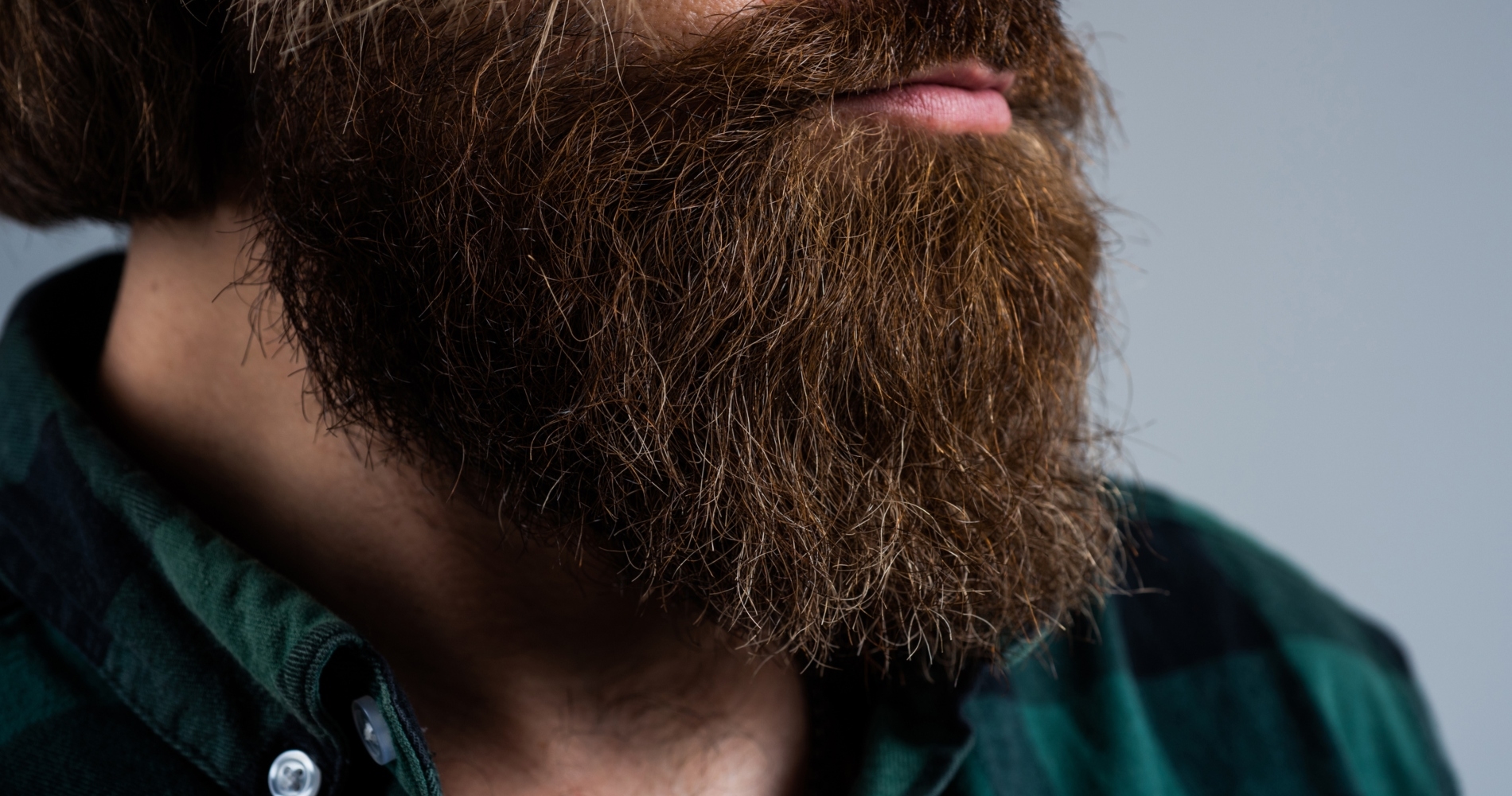 Μεταμόσχευση γενειάδας, κι όμως γίνεται - εικόνα 1