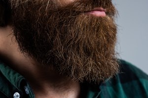 Μεταμόσχευση γενειάδας, κι όμως γίνεται - εικόνα 1