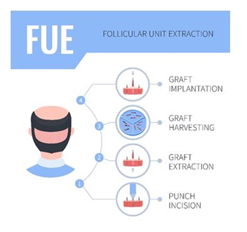 ΜΕΤΑΜΟΣΧΕΥΣΗ ΜΑΛΛΙΩΝ