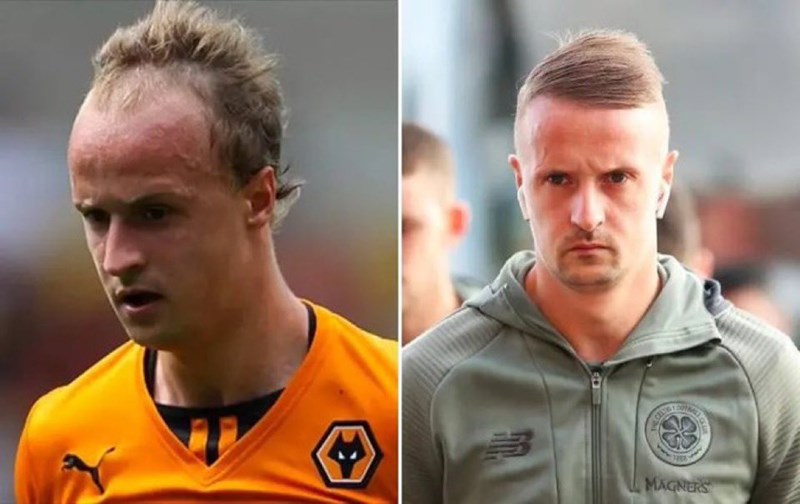 Η μεταμόσχευση μαλλιών του Γκρίφθς