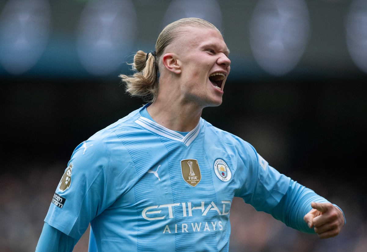 Ο Guardiola εμφανίστηκε με πληγές στο πρόσωπο-τι έχει συμβεί - εικόνα 1