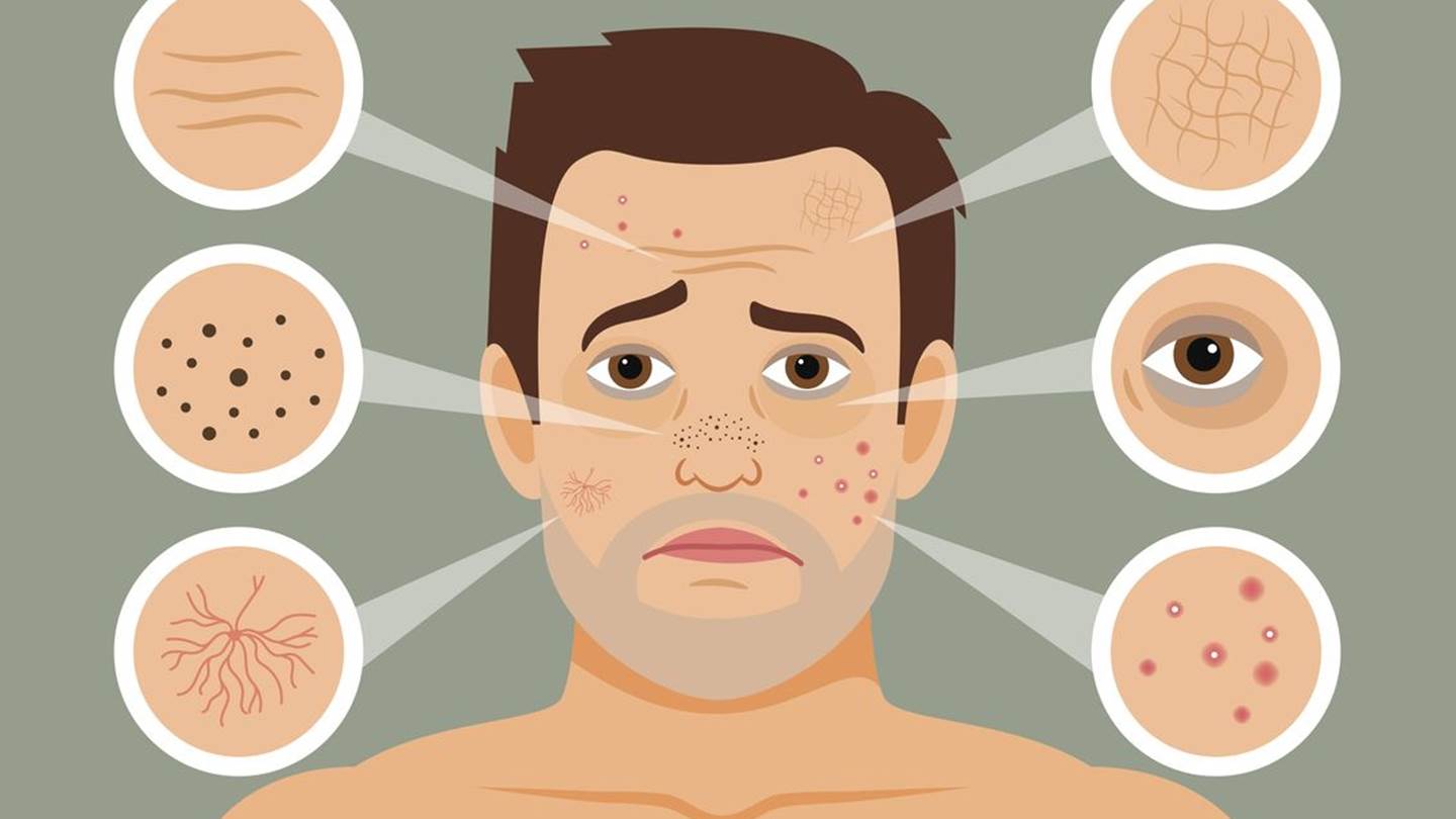 Η φροντίδα της επιδερμίδας σβήνει το στρες από το πρόσωπο