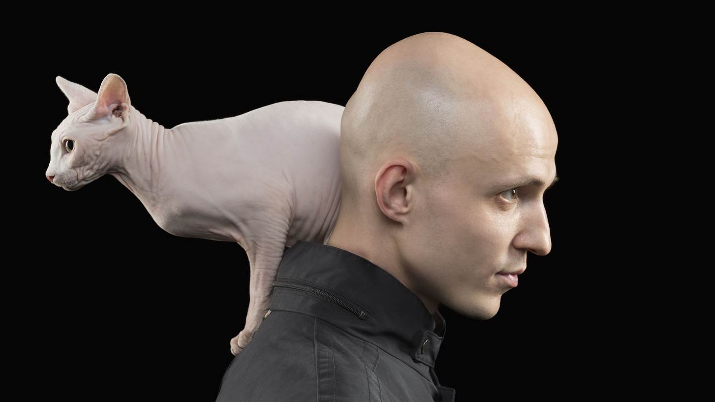 Βρέθηκε το φάρμακο κατά της φαλάκρας;