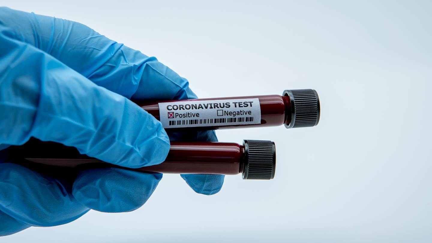 Το πρώτο κρούσμα της βρετανικής μετάλλαξης του κορονοϊού επιβεβαιώθηκε στην Νέα Υόρκη