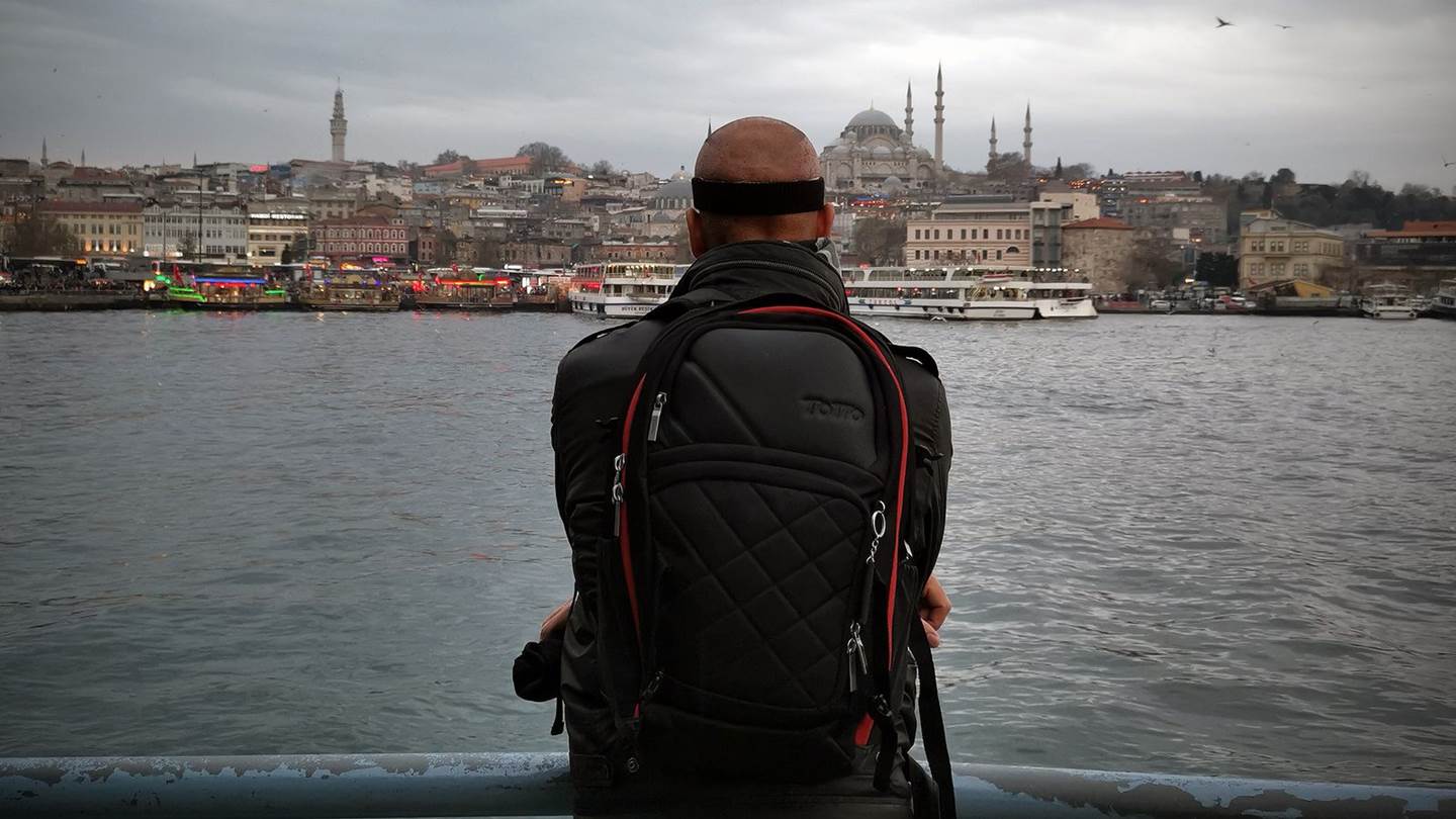 Μεταμόσχευση μαλλιών στην Τουρκία: Μια αληθινή μαρτυρία