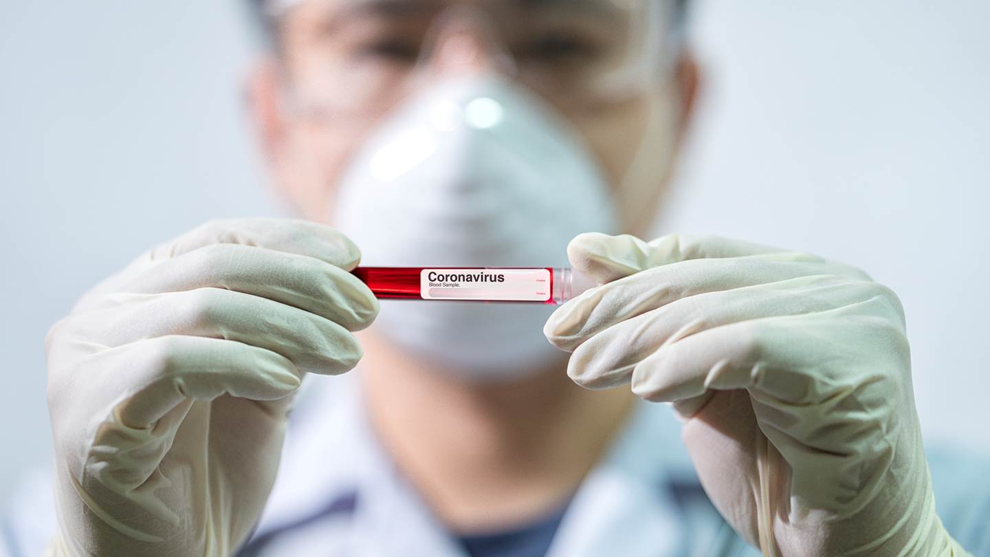 Ο ΠΟΥ διερευνά την προέλευση της COVID-19