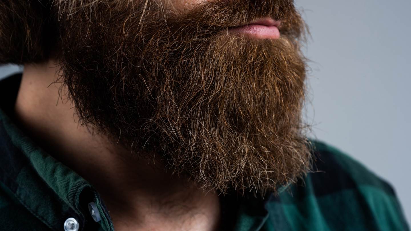 Ελεύθερος -κι ωραίος- από την πιτυρίδα στο μούσι