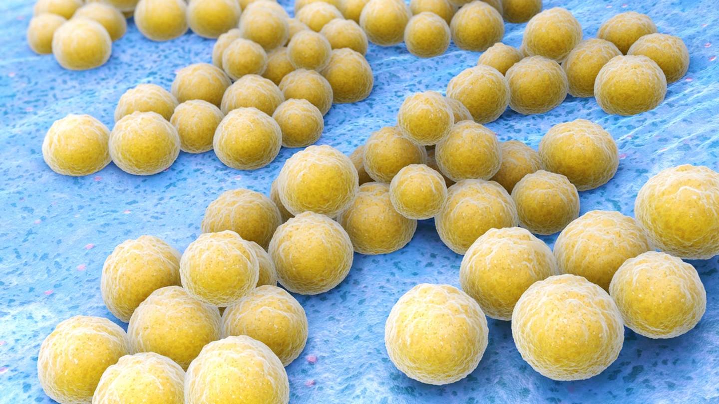 Τι είναι ο χρυσίζων σταφυλόκοκκος που οδήγησε στον θάνατο τον ψυχολόγο Δημήτρη Σκούρα