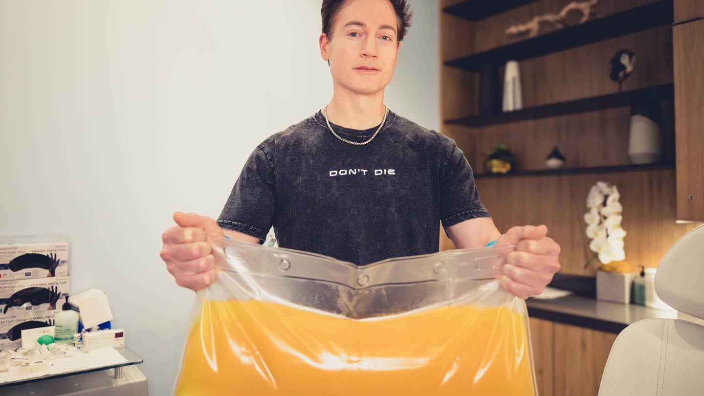 Mεγιστάνας αφαίρεσε 'όλο το πλάσμα από το σώμα του' για να δείχνει νεότερος