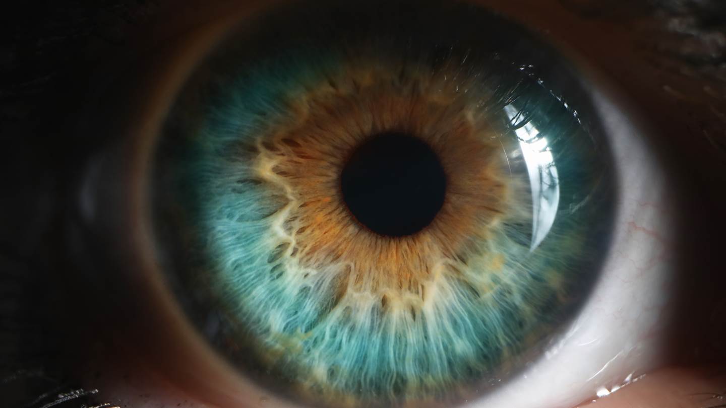 Αν έχεις αυτό το χρώμα ματιών, μάλλον είσαι πολύ 'τυχερός'