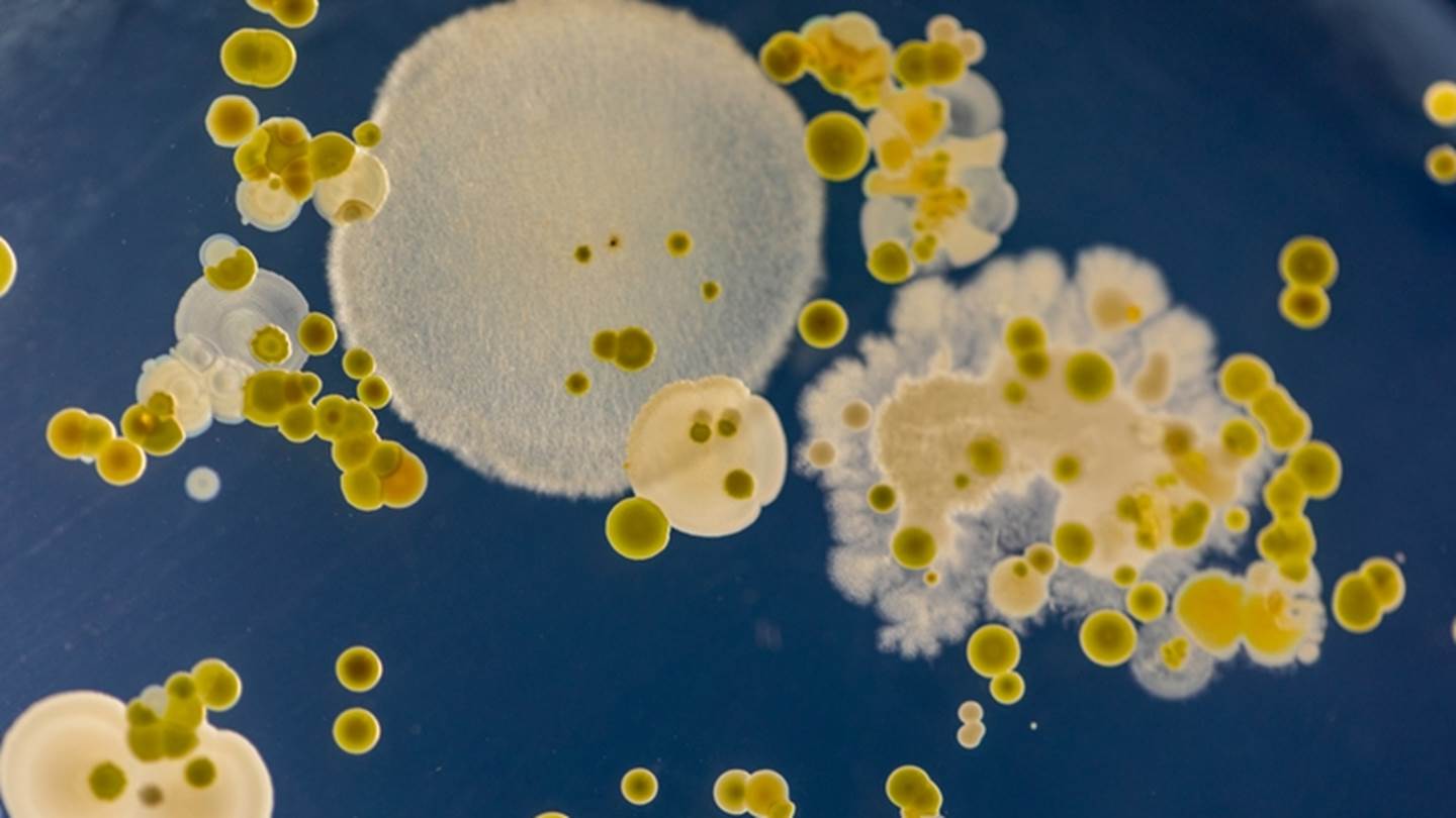 Ένας μύκητας 'σπέρνει' τον πανικό στα νοσοκομεία. Αλλά γιατί;