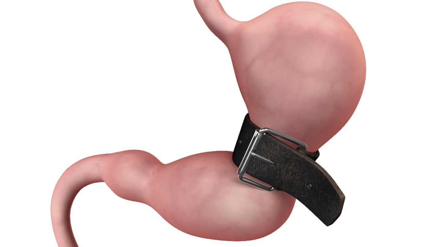 Ποια επέμβαση παχυσαρκίας σας ταιριάζει και για ποιους λόγους;