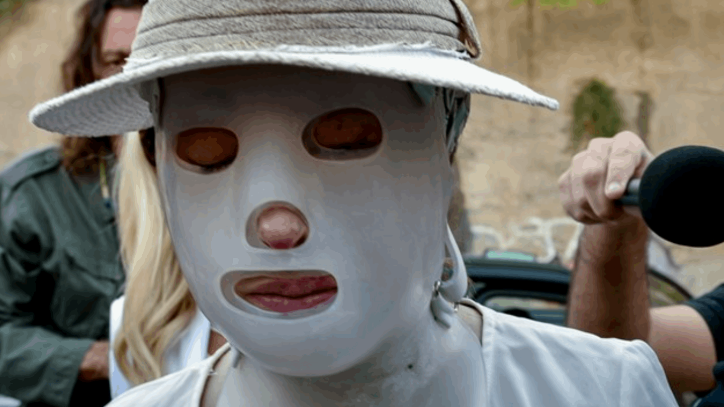 Επίθεση με βιτριόλι: Καταθέτουν στο δικαστήριο οι γιατροί της Ιωάννας Παλιοσπύρου