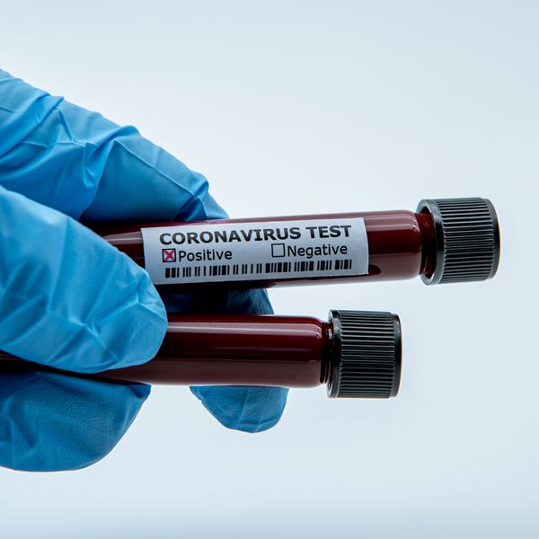 Το πρώτο κρούσμα της βρετανικής μετάλλαξης του κορονοϊού επιβεβαιώθηκε στην Νέα Υόρκη