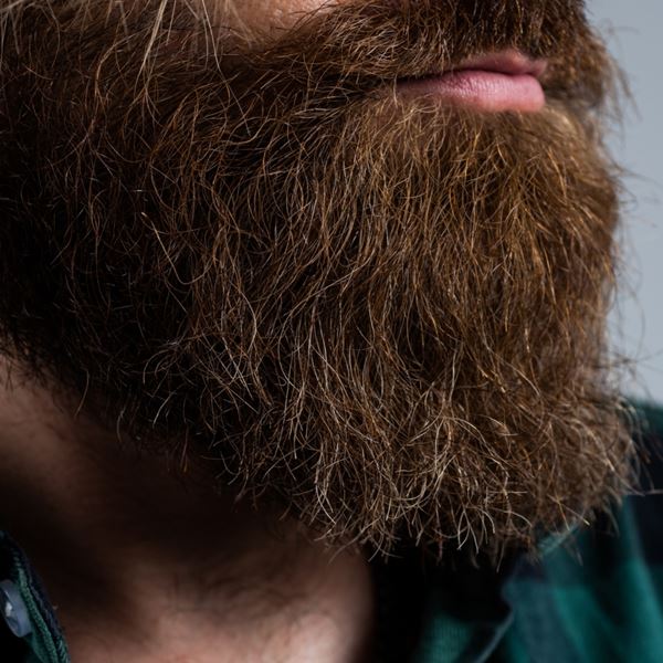 Ελεύθερος -κι ωραίος- από την πιτυρίδα στο μούσι