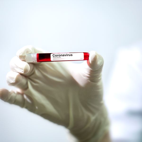 Ο Ηλίας Μόσιαλος εξηγεί γιατί θα είναι επικίνδυνο να ξεφύγει το νέο στέλεχος του κορονοϊού