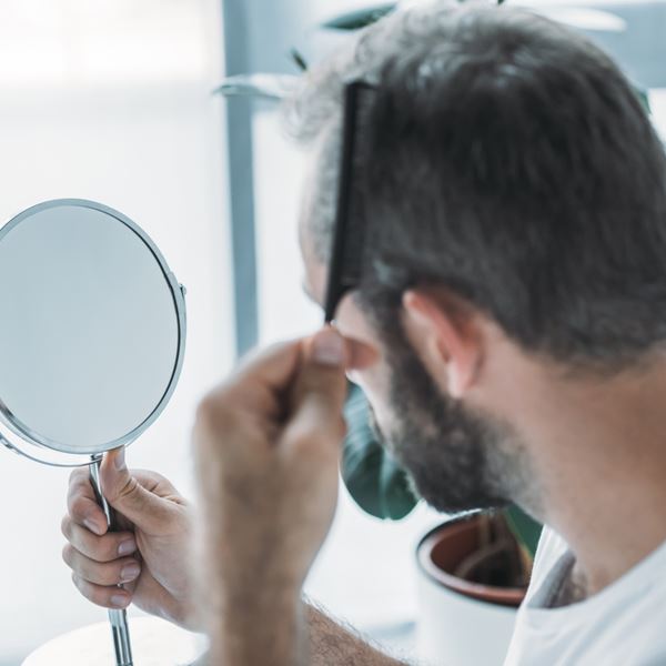 Όλη η αλήθεια για τη μεταμόσχευση μαλλιών