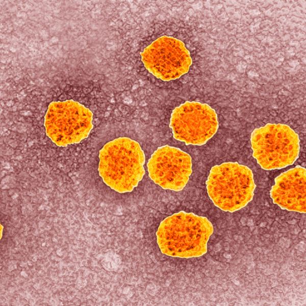 Το Νόμπελ Ιατρικής σε τρεις επιστήμονες που ανακάλυψαν τον ιό της ηπατίτιδας C