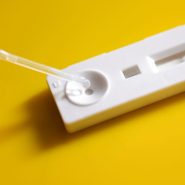 Νέο διαγνωστικό τεστ ανιχνεύει τον SARS-CoV-2 σε μόλις 5'