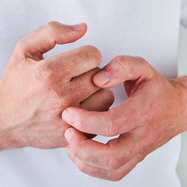 Είναι επικίνδυνο να κάνουμε κρακ στα δάχτυλά μας;